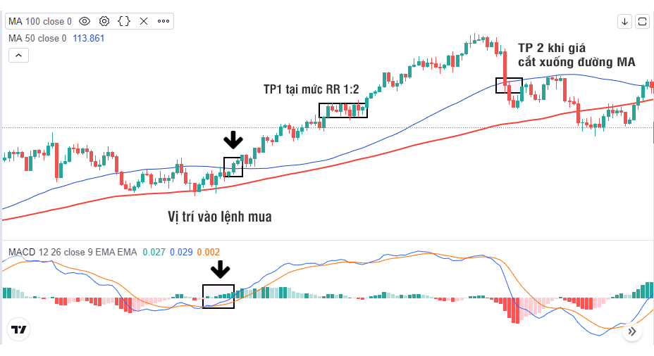 Phương pháp MACD nâng cao, chuyên sâu. Kết hợp MACD và MA